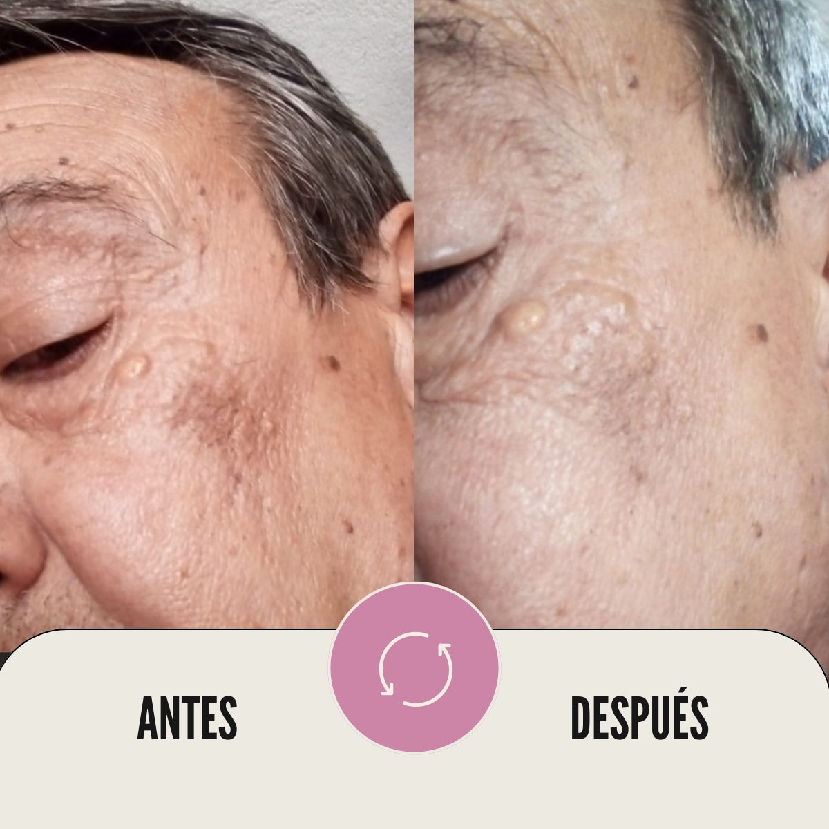 Sérum antimanchas alpha arbutina 2% + ácido kójico 5%