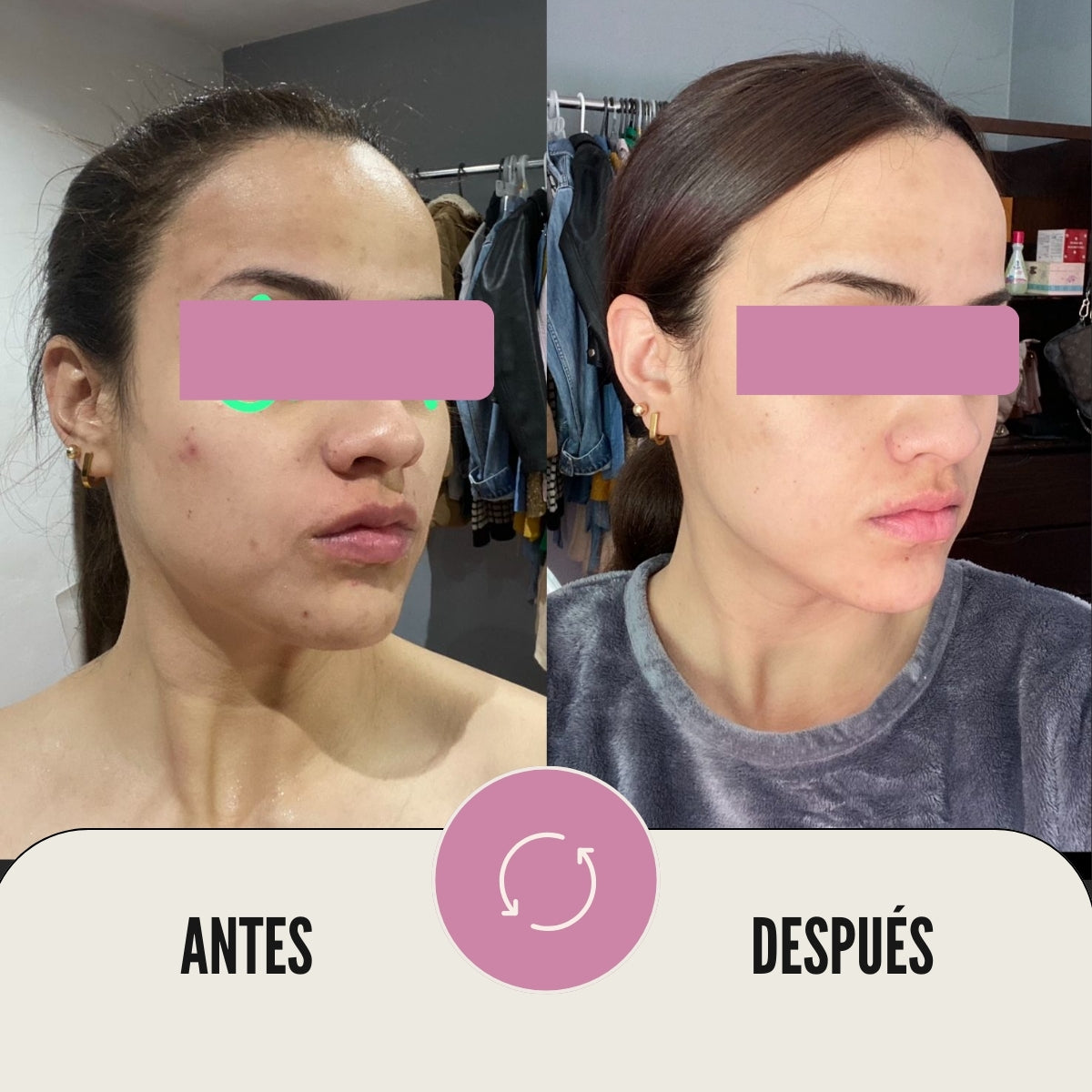 Sérum antimanchas alpha arbutina 2% + ácido kójico 5%