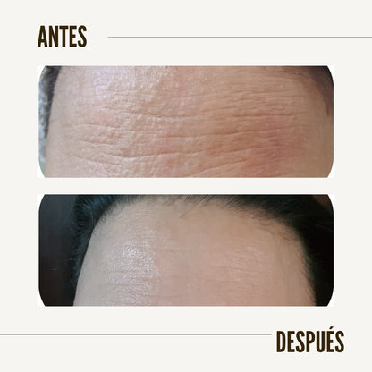 Kit Sérum y cremas antiedad- rejuvenece tu piel en 20 días
