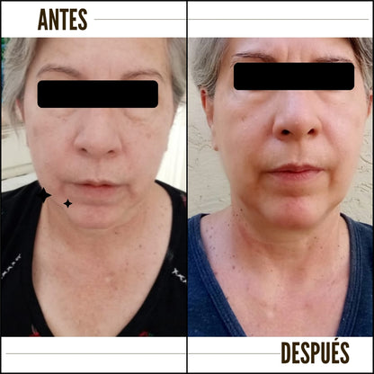 Kit Sérum y cremas antiedad- rejuvenece tu piel en 20 días