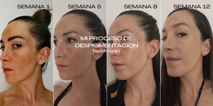 Peeling mancha localizada AHA 7% + ácido azelaico 10% + ácido tranexámico 3%
